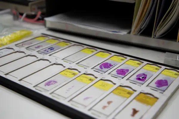 Histology slides