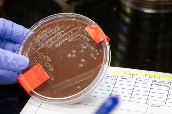 Gloved hand holds petri dish in lab.